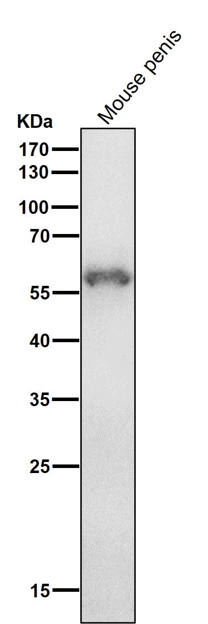 All lanes use the Antibody at 1:1K dilution for 1 hour at room temperature.