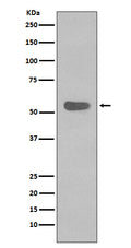Western blot analysis of Cytokeratin 4 expression in A431 cell lysate.