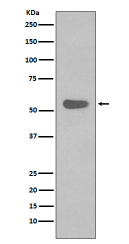 Western blot analysis of Cytokeratin 4 expression in A431 cell lysate.