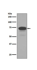 Western blot analysis of 5T4 expression in MCF-7 cell lysate.
