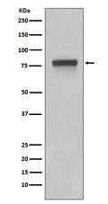 Western blot analysis of 5T4 expression in Caco-2 cell lysates.