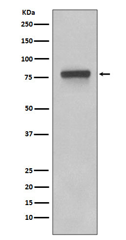 Western blot analysis of 5T4 expression in Caco-2 cell lysates.