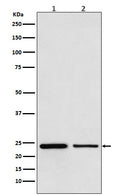Anti-TBPL1 Monoclonal Antibody