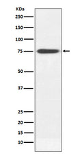 Western blot analysis of Human IgM expression in human plasma lysate.