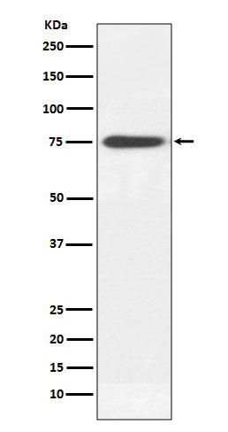 Western blot analysis of Human IgM expression in human plasma lysate.
