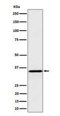 Western blot analysis of Pyrophosphatase 1 expression in HepG2 cell lysate.