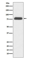 Western blot analysis of TBR1 expression in human fetal brain lysate.