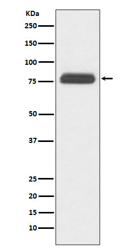 Western blot analysis of TBR1 expression in human fetal brain lysate.