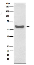 Western blot analysis of IgA expression in human plasma lysate.
