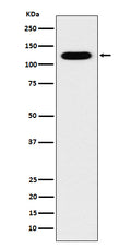 Western blot analysis of Cadherin 16 expression in Human fetal kidney lysate.