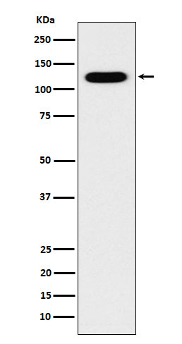 Western blot analysis of Cadherin 16 expression in Human fetal kidney lysate.