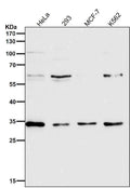 All lanes use the Antibody at 1:2K dilution for 1 hour at room temperature.