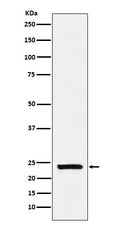 Western blot analysis of Casein expression in Human milk lysate.