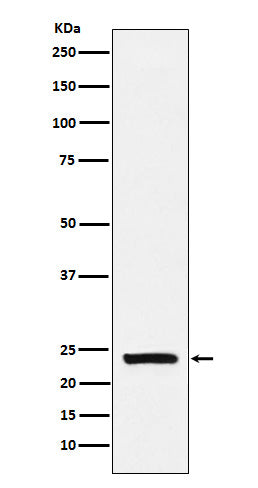 Western blot analysis of Casein expression in Human milk lysate.