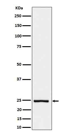 Western blot analysis of IL26 in His-tagged IL26 cell lysate.