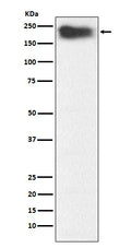 Western blot analysis of MYH7B expression in Human fetal muscle lysate.