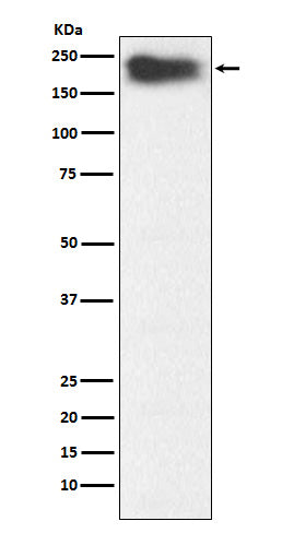 Western blot analysis of MYH7B expression in Human fetal muscle lysate.