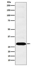 Western blot analysis of Proteasome 20S C2 expression in PC3 cell lysate.