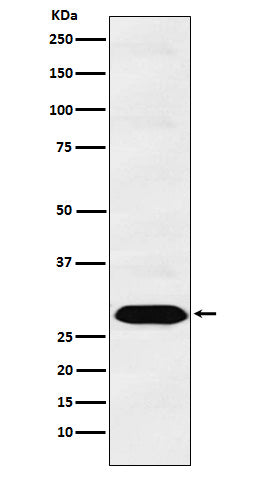 Western blot analysis of Proteasome 20S C2 expression in PC3 cell lysate.