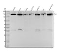 Anti-R Cadherin Rabbit Monoclonal Antibody