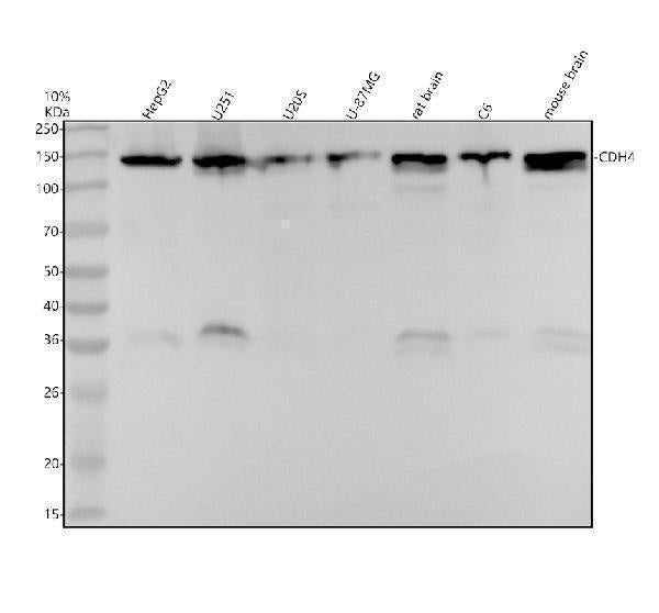 Anti-R Cadherin Rabbit Monoclonal Antibody