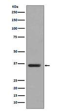 Western blot analysis of PP2A alpha+beta expression in T47 D cell lysate.