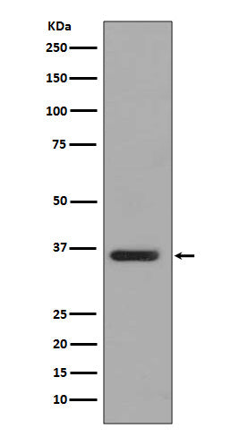 Western blot analysis of PP2A alpha+beta expression in T47 D cell lysate.