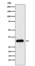 Western blot analysis of Apolipoprotein F expression in human plasma cell lysate.