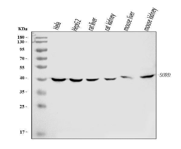 Anti-Sorbitol Dehydrogenase/SORD Antibody Picoband® (monoclonal, 12B10G2)