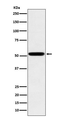 Anti-Human IgG2 Rabbit Monoclonal Antibody