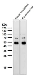 All lanes use the Antibody at 1:1K dilution for 1 hour at room temperature.
