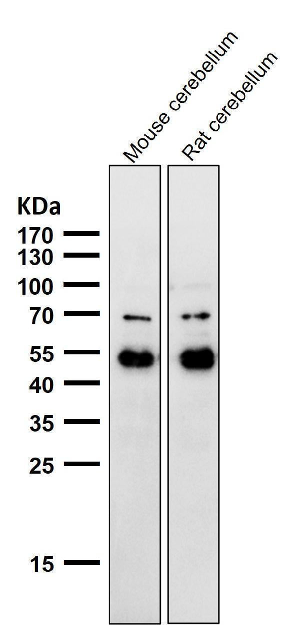 All lanes use the Antibody at 1:1K dilution for 1 hour at room temperature.