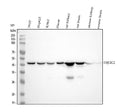 Anti-UQCRC2 Monoclonal Antibody