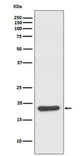 Western blot analysis of Hsp20 expression in mouse skeletal muscle lysate.