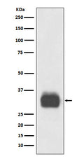 Western blot analysis of Mast Cell Tryptase expression in Human tonsil lysate.