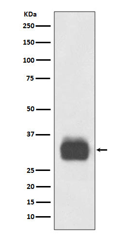 Western blot analysis of Mast Cell Tryptase expression in Human tonsil lysate.