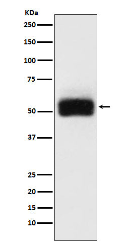 Western blot analysis of MMP17 expression in HeLa cell lysate.