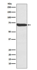 Western blot analysis of Frizzled 9 expression in Human Seminoma lysate.