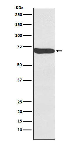 Western blot analysis of Frizzled 9 expression in Human Seminoma lysate.