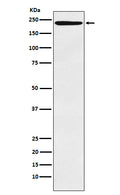 Western blot analysis of LY75 expression in Human tonsil lysate.