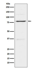 Western blot analysis of Insulin Receptor R expression in Hela cell lysate.