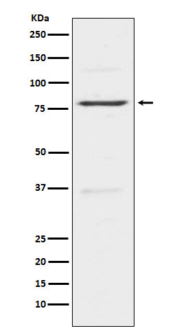 Western blot analysis of Insulin Receptor R expression in Hela cell lysate.