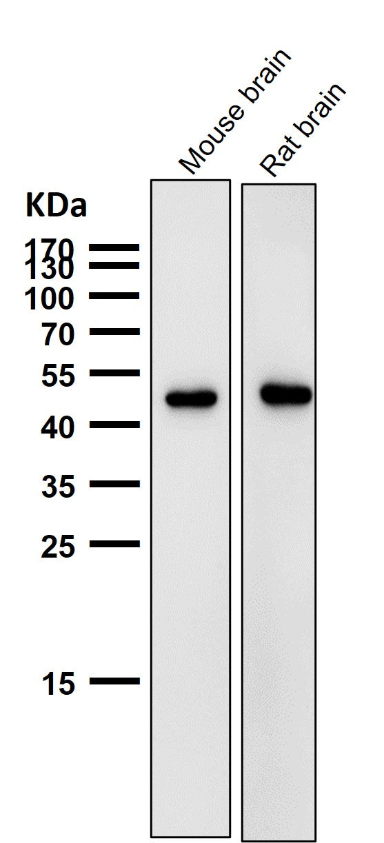 All lanes use the Antibody at 1:1K dilution for 1 hour at room temperature.