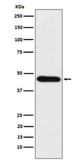Western blot analysis of CDC123 expression in HeLa cell lysate.