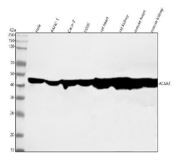 Anti-ACAA2 Rabbit Monoclonal Antibody