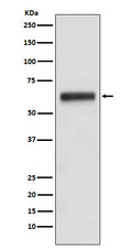 Western blot analysis of Human IgG3 expression in human plasma lysate.