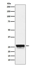 Western blot analysis of CTRL expression in Mouse pancreas lysate.