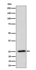 Western blot analysis of RPL10A expression in HeLa cell lysate.