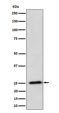 Western blot analysis of RPL10A expression in HeLa cell lysate.