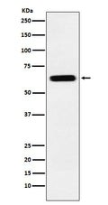 Western blot analysis of CRMP5 expression in SH-SY5Y cell lysate.